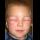 Profilbild von Anaphylaxie
