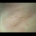 Profilbild von Allergie
