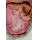 Profilbild von carcinoma linguae