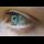 Profilbild von Eyelid