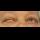 Profilbild von myasthenia gravis